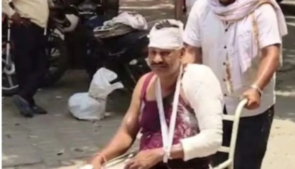 पुलिस पर हमला : कौशांबी में पुलिस टीम को घेरकर की मारपीट, 5 गिरफ्तार, कई फरार