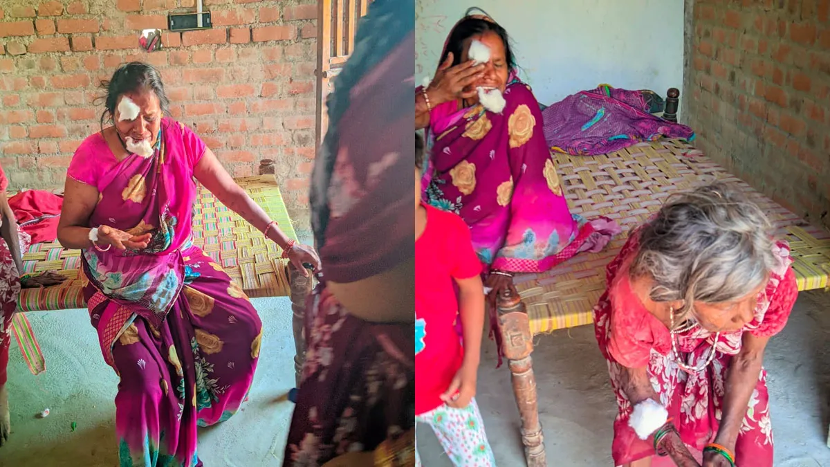जंगली जनवर के हमले से घायल महिलाएं