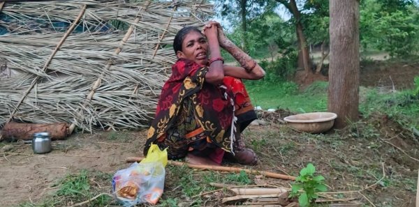 इंसानियत पर सवाल : बीमारी को छूत मान कर परिवार ने 20 साल से पीड़ित महिला को झोपड़ी में छोड़ा