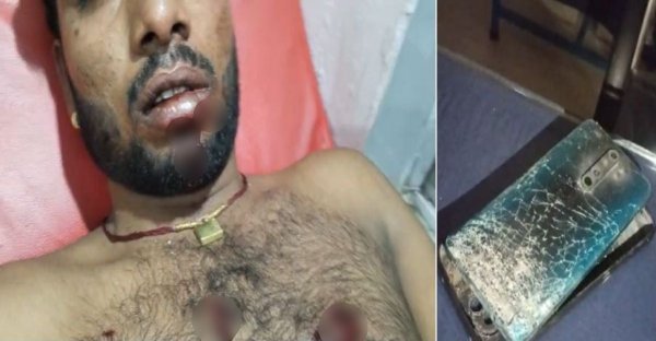 दर्दनाक हादसा : खजुराहो में सगाई समारोह के दौरान मोबाइल ब्लास्ट, वीडियो बना रहा युवक गंभीर घायल
