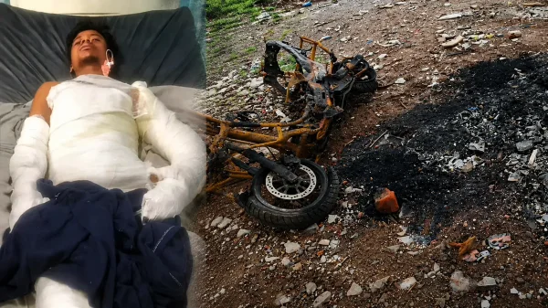 रायपुर में दोस्ती का खौफनाक अंत : पार्टी के बहाने ले गए फिर पेट्रोल डालकर जलाया, युवक की इलाज के दौरान मौत