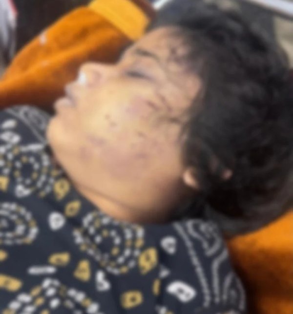 लिव-इन रिलेशनशिप में रह रही थी बीएड छात्रा, बहन ने पार्टनर पर लगाया ये गंभीर आरोप