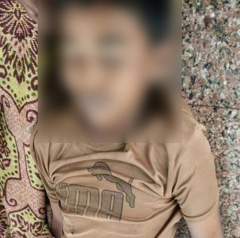 Dhamtari Snake Bite: 13 साल के बच्चे करैत सांप ने डसा, इलाज के दौरान मौत