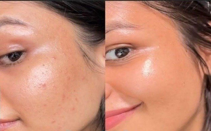Rice Water and Aloe Vera Night Gel (Image Source: Social Media)