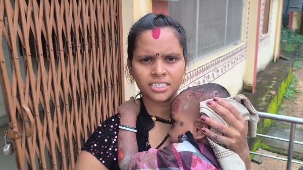 Jhalap Bagbahara Road Accident: गोद से उछलकर सड़क पर गिरा डेढ़ साल का मासूम, सिर पर आए टांके