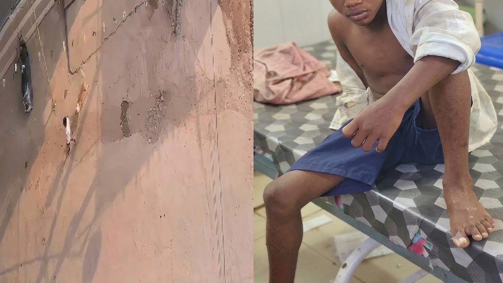 Chhattisgarh News: सारंगढ़-बिलाईगढ़ में आवारा कुत्ते का आतंक, 31 लोगों को काटकर किया घायल