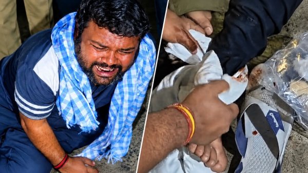 Sagar liquor case: 30 हजार के इनामी मुख्य आरोपी मनीष का एनकाउंटर, पैर में लगी गोली
