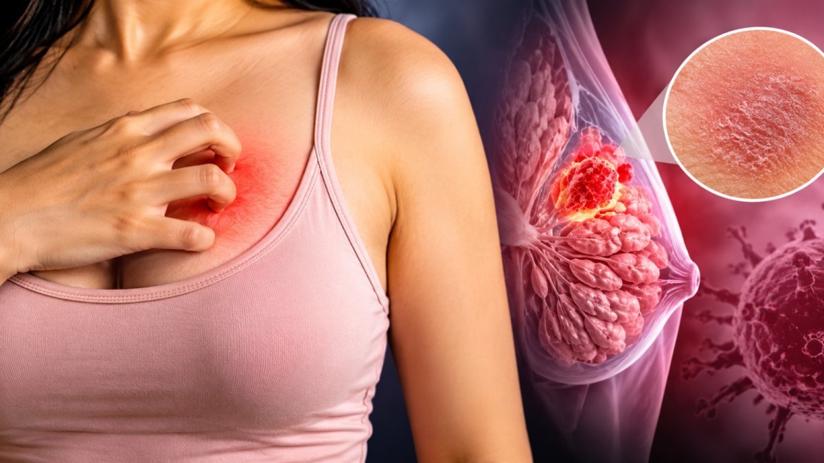 Itchy Breasts Causes (Image Source: AI Generated)