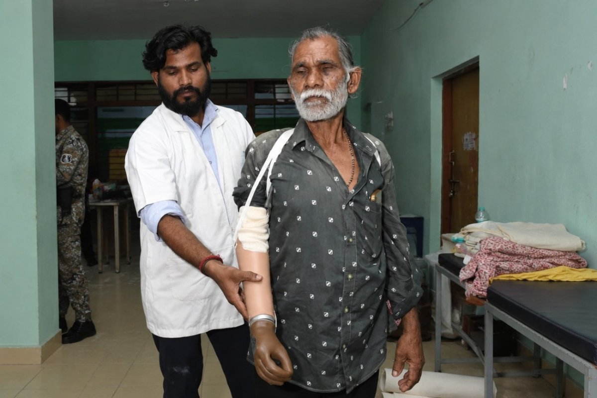 Tejram Sahu Receives Artificial Hand in Dhamtari(Image Source:CGDPR)