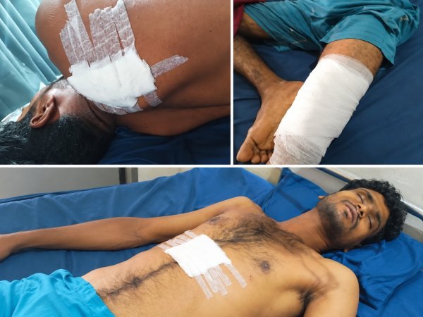 Crime News: रायपुर में चाकूबाजी की दो वारदात, तीन युवक घायल
